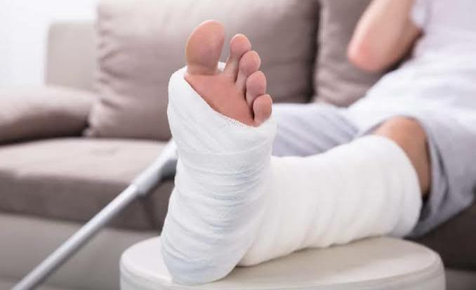 Kaki Mengalami Patah Tulang? Lakukan 3 Hal Ini Sebagai Pertolongan Pertama