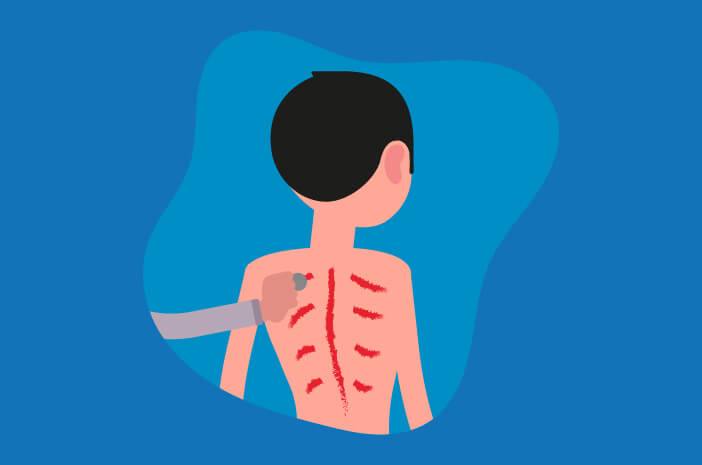 Menguak 4 Fakta Kerokan, Benarkah Menyebabkan Lahiran Prematur?