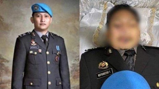 Luka di Leher Brigadir J Bukan Jeratan, Tapi Bekas Ini..