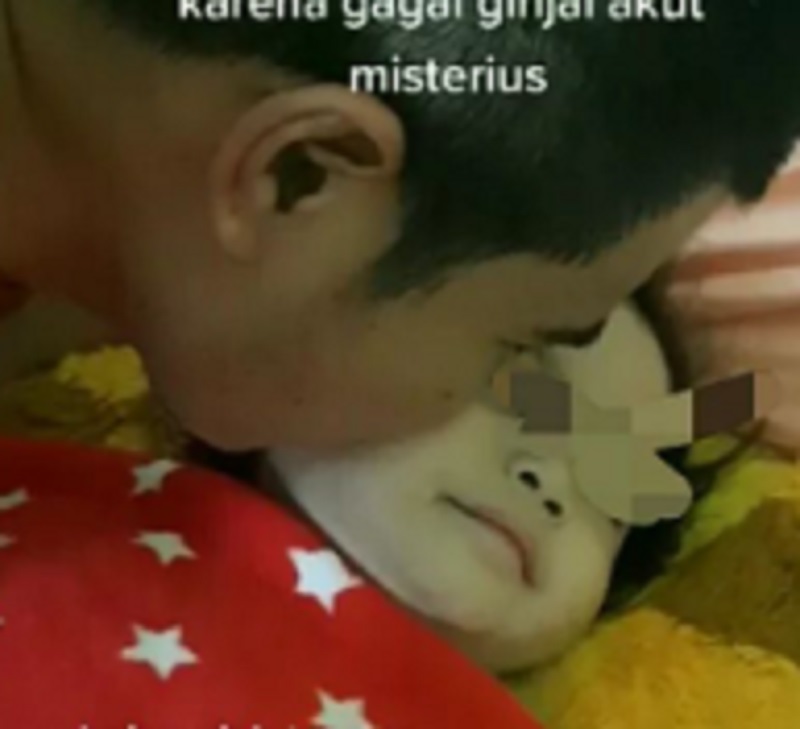 Labfor Polri Turun Tangan Soal Dugaan Gagal Ginjal Akut Anak, Beberapa Pasien Diperiksa