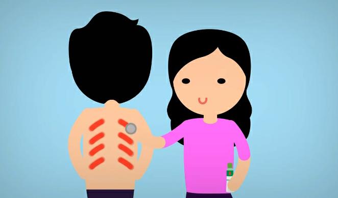 Jangan Dianggap Sepele! Ini Dampak Buruk Akibat Terlalu Sering Kerokan
