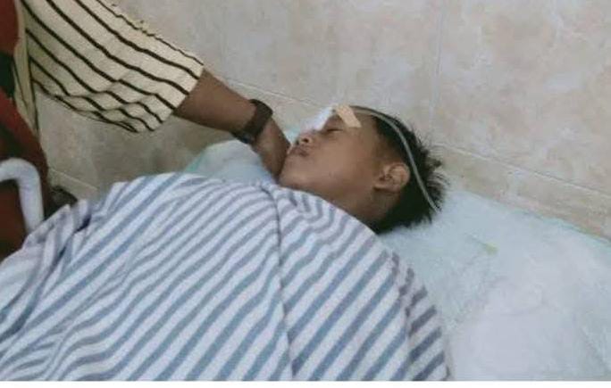 Permainan Meriam Kaleng di Mesuji Kembali Menelan Korban, Seorang Anak Terluka di Mata