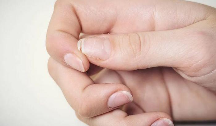 Jangan Sampai Terlambat! Ini 5 Tanda Gejala Tubuh Terserang Osteoporosis yang Wajib Diketahui