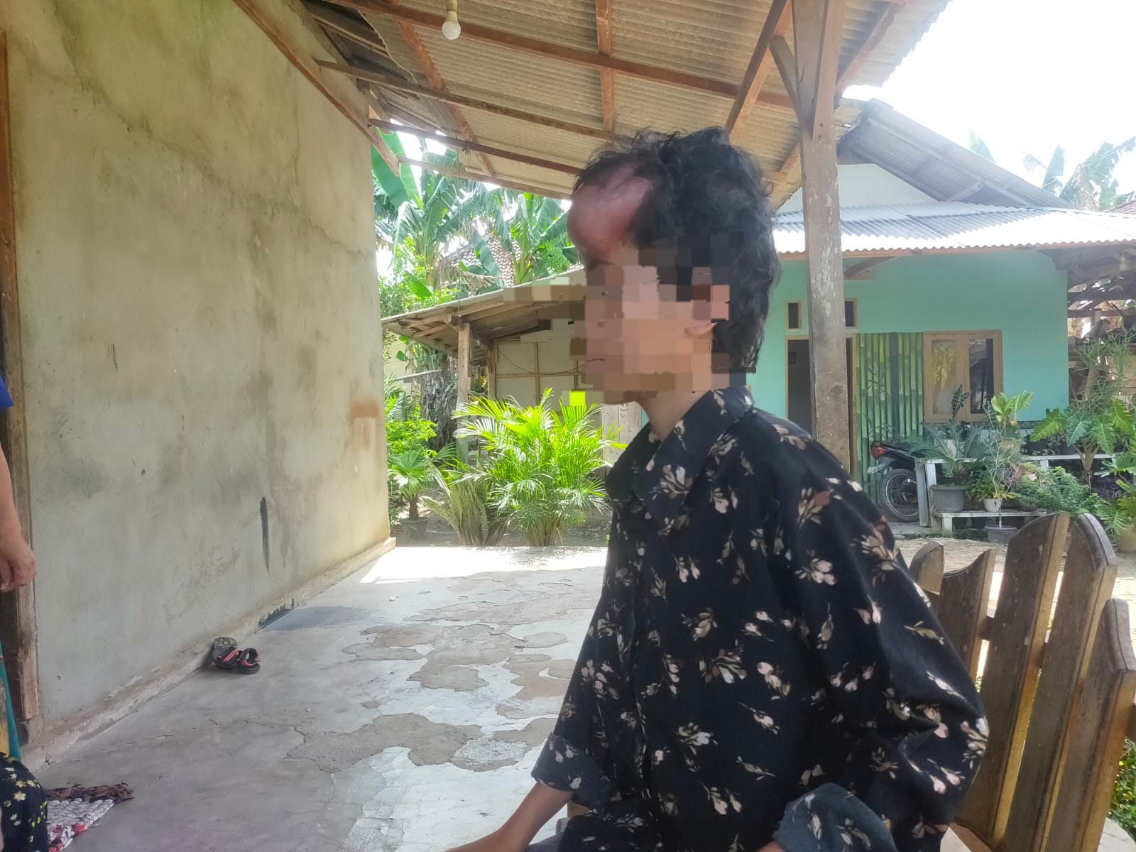 Alami Kanker Otak, Wanita di Mesuji Ini Butuh Uluran Tangan Para Dermawan