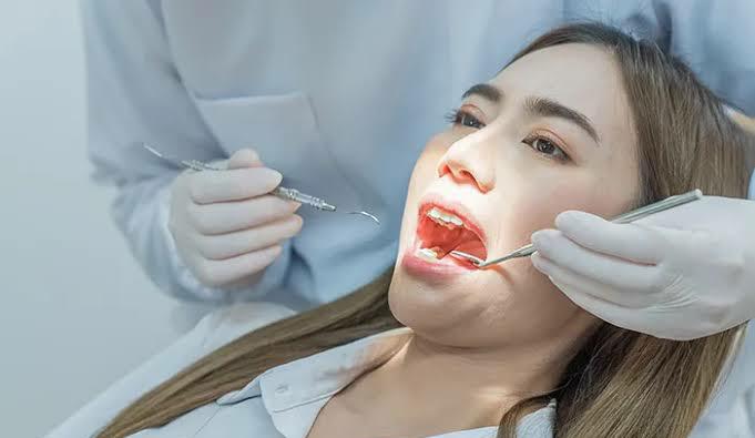 Begini Cara Tambal Gigi Gratis Pakai BPJS Kesehatan