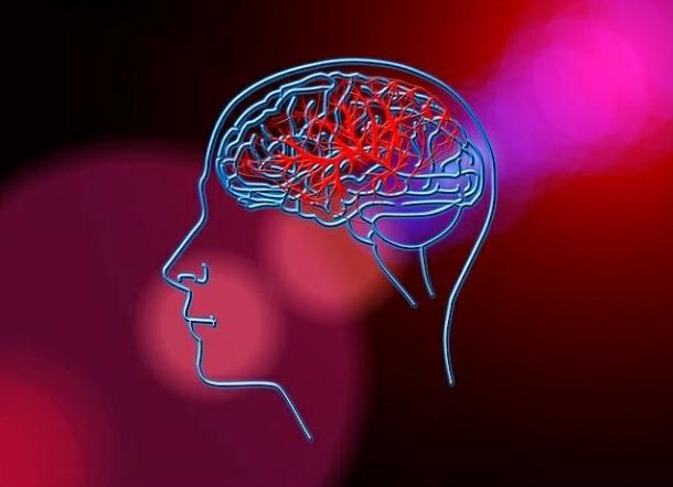 Mengenal Hidrosefalus, Penyebab dan Dampaknya
