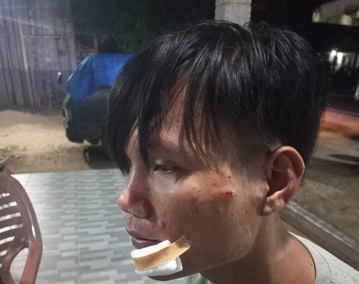 Gara-gara Klakson di Jalan, Pemuda jadi Korban Pemukulan dan Diduga Sempat Ditembak pakai Senpi