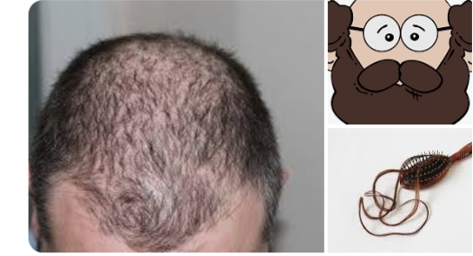 Enam Cara Mengatasi Kerontokan Rambut dengan Bahan Alami