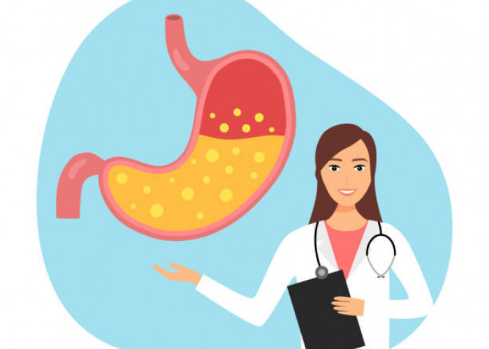 7 Rekomendasi Obat Asam Lambung Aman dan Ampuh 