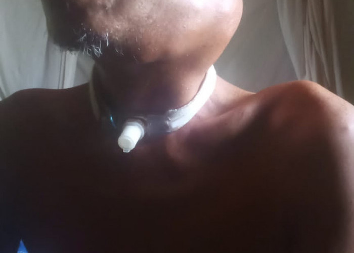 Kemensos Jemput Sujoko Warga Mesuji yang Derita Kanker Tonsil