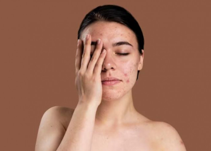 5 Cara Merawat Kulit Wajah Pada Usia 40 Tahun Ke Atas, Saatnya Tampil Glowing Kencang