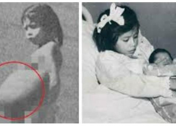 Kisah Ibu Termuda di Dunia, Gadis Cantik Asal Peru yang Melahirkan Anak di Usia 5 Tahun