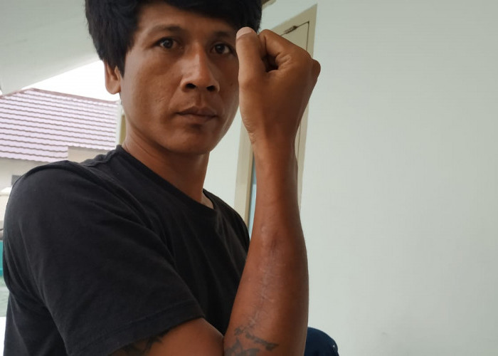 Nestapa Korban Lakalantas: Rumah Tangga Bubar, Kini Harap Keadilan