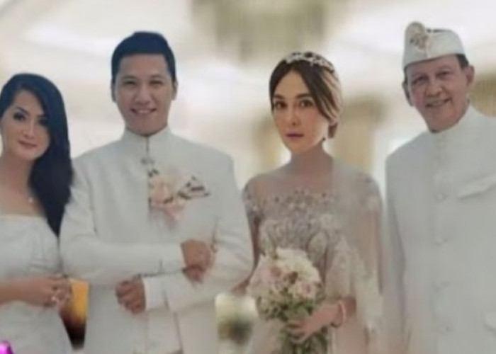 Luna Maya Menikah dengan Gading Marten? Ini Faktanya