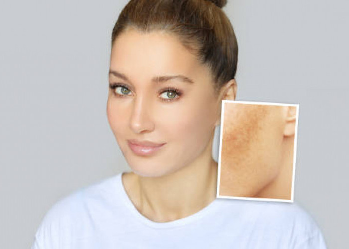 Ingin Punya Wajah Cerah dan Glowing? Berikut Ini 9 Tips Ampuh Atasi Kulit Kusam