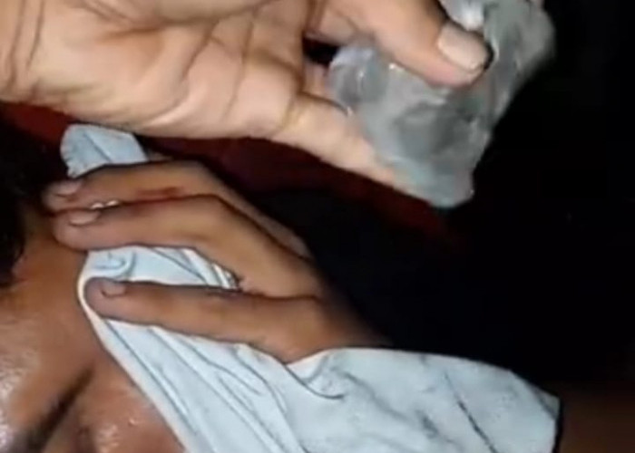 Viral di Medsos Truk Dilempar Batu hingga Mengenai Kepala, Begini Tanggapan Polres Mesuji