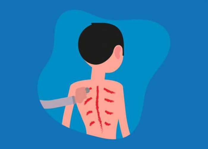 Menguak 4 Fakta Kerokan, Benarkah Menyebabkan Lahiran Prematur? 