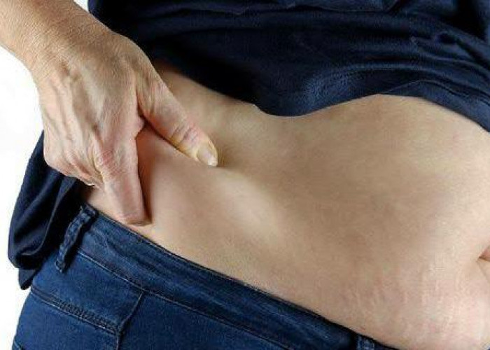 Beberapa Cara Mengatasi Perut Buncit yang Begah