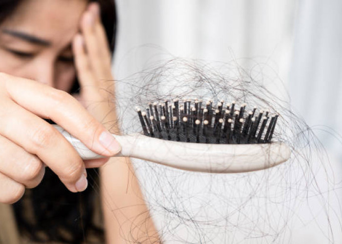 4 Tips Mencegah Rambut Rontok dan Penyebabnya, Yuk Simak!