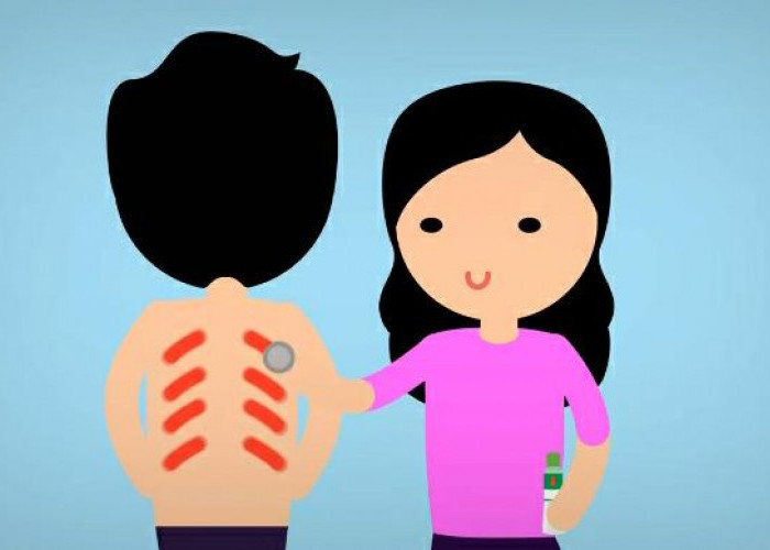 Jangan Dianggap Sepele! Ini Dampak Buruk Akibat Terlalu Sering Kerokan