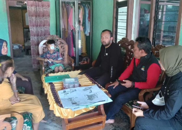 Akhirnya, Anak Pengidap Tumor Mata di Mesuji Mendapatkan Bantuan