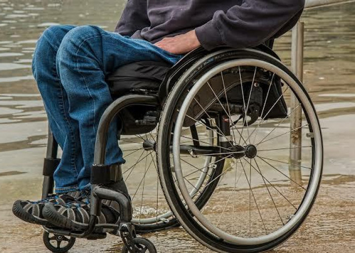 Jangan Remehkan Osteoporosis, Berikut Lima Bahaya Jika Tulang Mulai Keropos Sejak Usia Muda