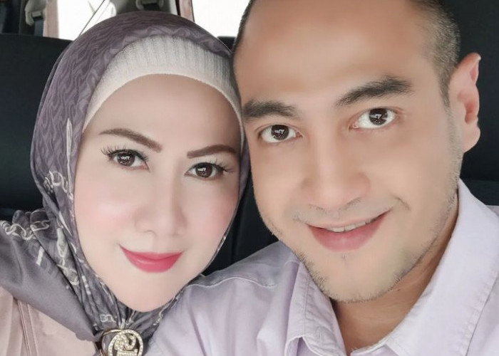 Jadi Korban KDRT, Venna Melinda Kabur dari Kamar Hotel dengan Hidung Berdarah