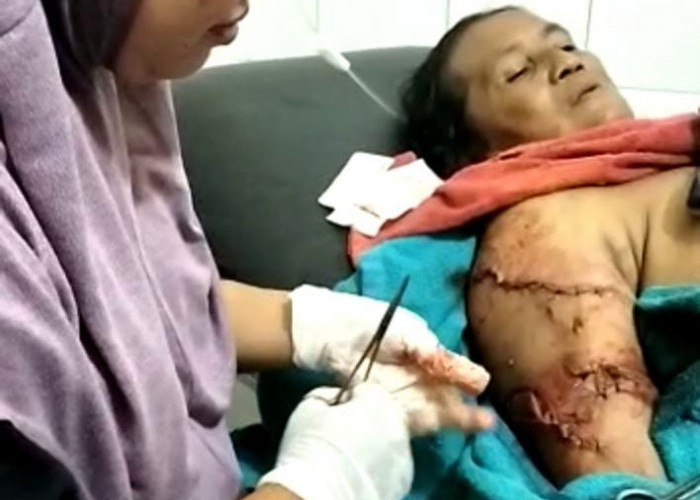 Wanita Paru Baya Digigit Buaya di Sungai Semaka Tanggamus