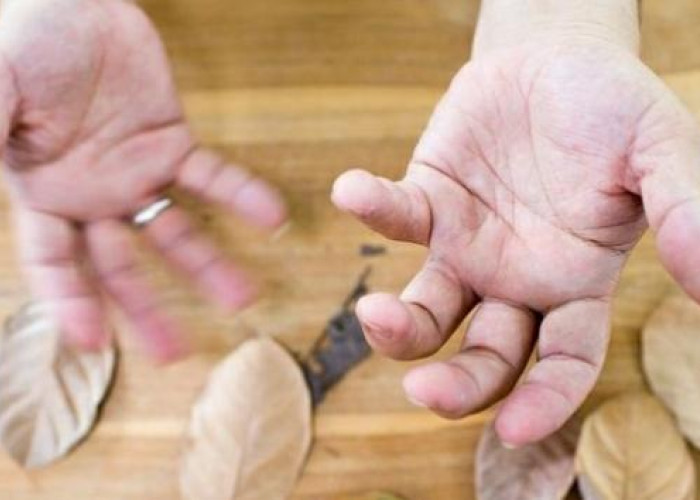 Apa Itu Hexymer yang Diklaim Bisa Atasi Parkinson? Berikut Ini Penjelasan Singkatnya  