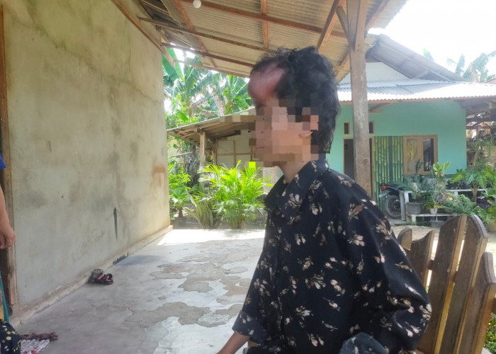 Alami Kanker Otak, Wanita di Mesuji Ini Butuh Uluran Tangan Para Dermawan