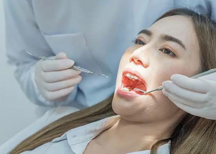 Begini Cara Tambal Gigi Gratis Pakai BPJS Kesehatan