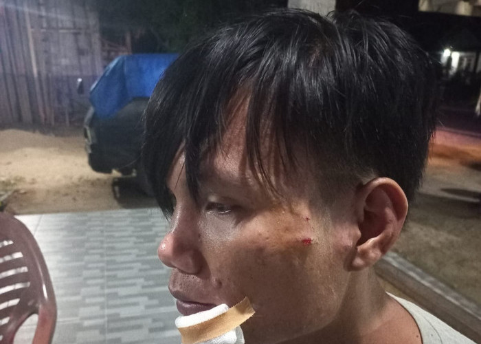 Gara-gara Klakson di Jalan, Pemuda jadi Korban Pemukulan dan Diduga Sempat Ditembak pakai Senpi