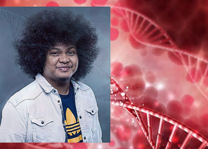 Mengenal Anemia Aplastik, Penyakit Langka yang Diderita Babe Cabita