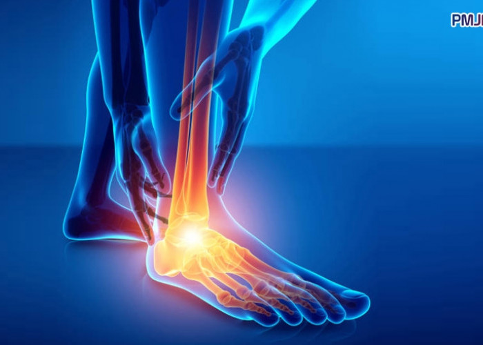 Jangan Sepelekan, Ini Gejala Kolesterol Tinggi yang Dirasakan di Kaki