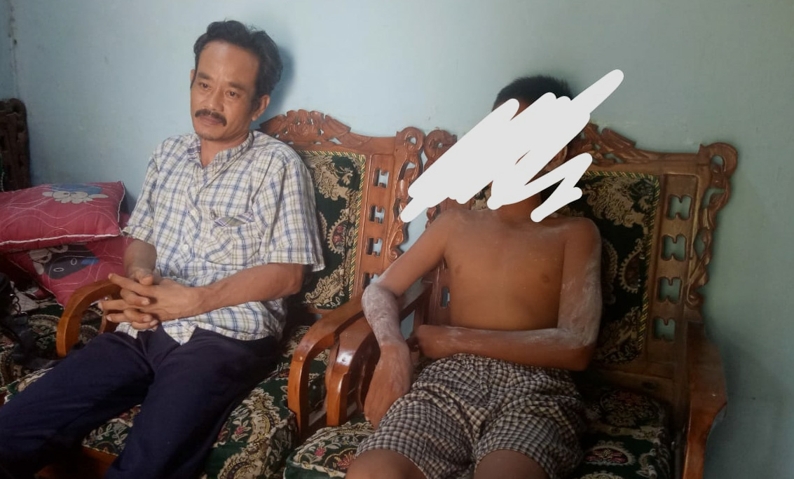 Nah, Korban Bullying Keluhkan Sakit di Kepala