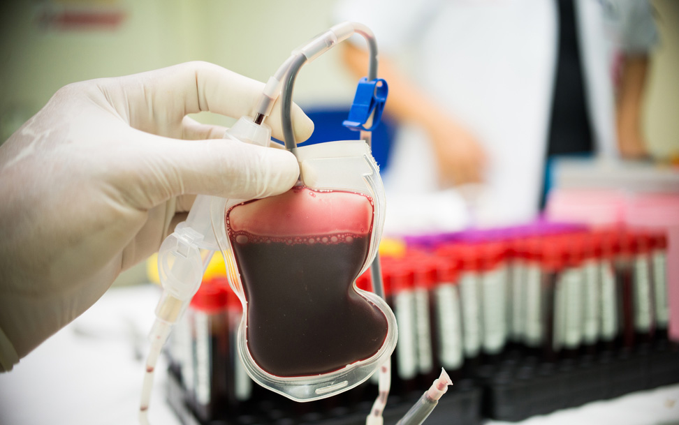 HUT Pesawaran, Ada Sunatan Massal dan Donor Darah