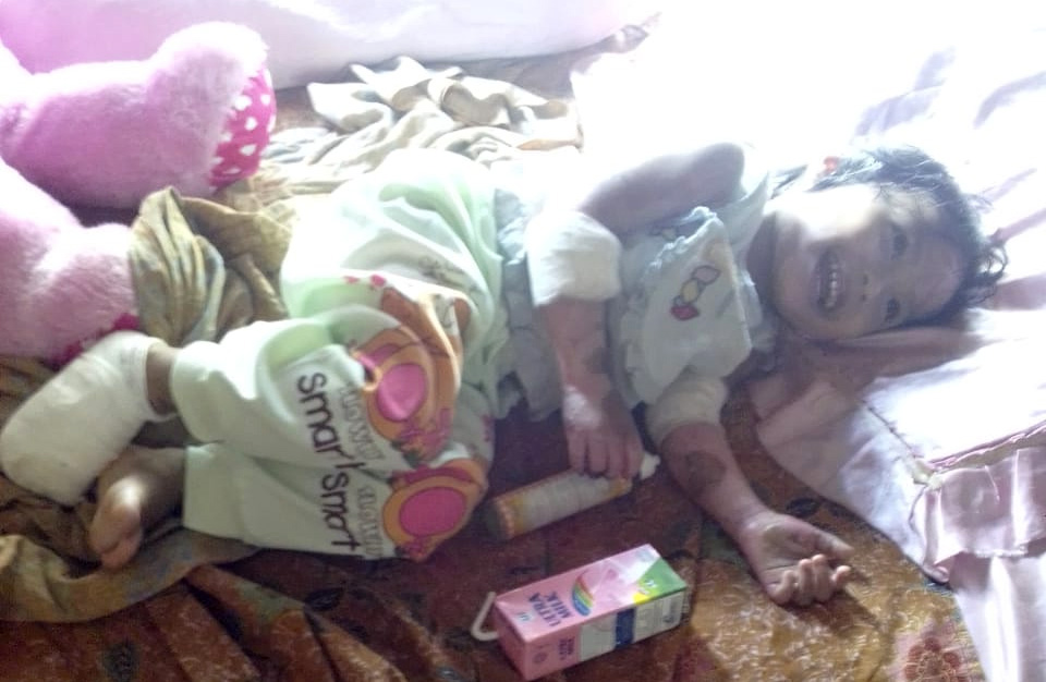 Alhamdulillah, Bayi Hanum Mulai membaik