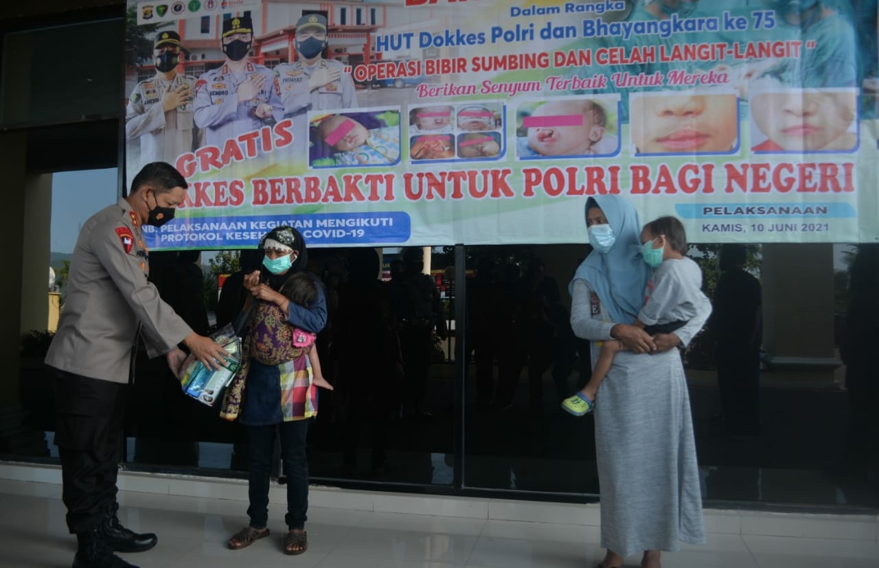 HUT Bhayangkara ke-75, Polda Lampung Berikan Bantuan Operasi Bibir Sumbing